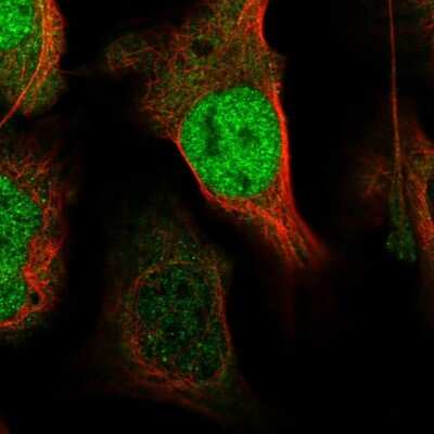 Immunocytochemistry/ Immunofluorescence: Exportin 4 Antibody [NBP2-56750]