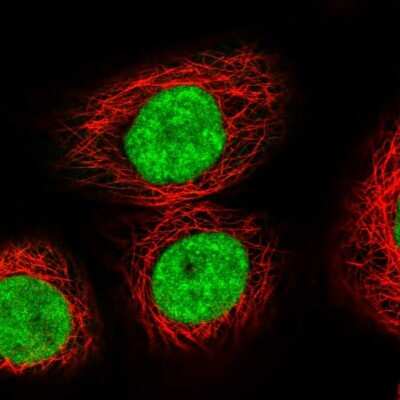 Immunocytochemistry/ Immunofluorescence: Exportin-5 Antibody [NBP1-89605]
