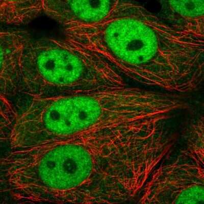 Immunocytochemistry/ Immunofluorescence: Exportin-T Antibody [NBP2-56900]