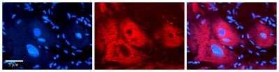 Immunohistochemistry: Ext2 Antibody [NBP1-58297]