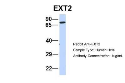 Western Blot: Ext2 Antibody [NBP1-58297]