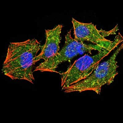 Immunocytochemistry/ Immunofluorescence: Ezrin Antibody (6F1C3) - BSA Free [NBP2-52464]