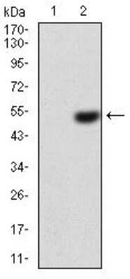 Western Blot: Ezrin Antibody (6F1C3)BSA Free [NBP2-52464]