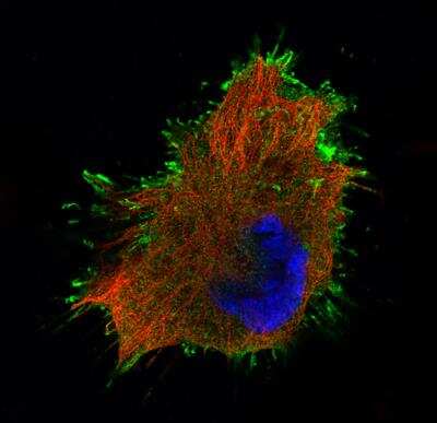 Immunocytochemistry/ Immunofluorescence: Ezrin Antibody (CL2360) [NBP2-36761]