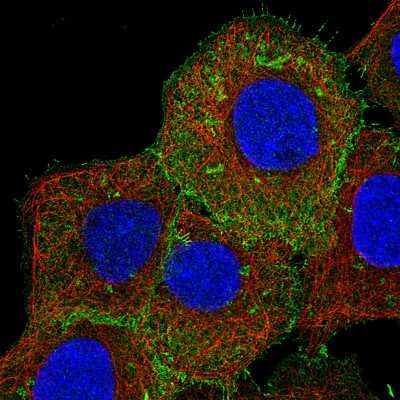 Immunocytochemistry/ Immunofluorescence: Ezrin Antibody (CL2378) [NBP2-36762]