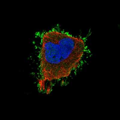 Immunocytochemistry/ Immunofluorescence: Ezrin Antibody (CL2378) [NBP2-36762]
