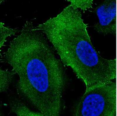 Immunocytochemistry/ Immunofluorescence: Ezrin Antibody (CL2384) [NBP2-36760]