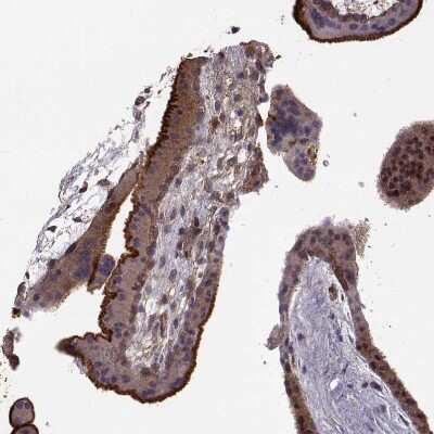 Immunohistochemistry-Paraffin: Ezrin Antibody (CL2384) [NBP2-36760]