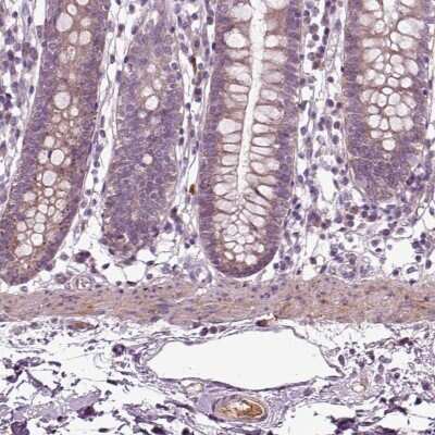 Immunohistochemistry-Paraffin: F-Spondin/SPON1 Antibody [NBP2-69044]