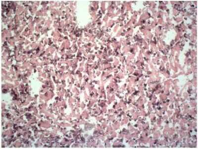 Immunohistochemistry: F4/80 Antibody (BM8) [NBP1-60140]