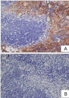 Immunohistochemistry-Frozen: F4/80 Antibody (CI-A3-1) - BSA Free [NB600-404]