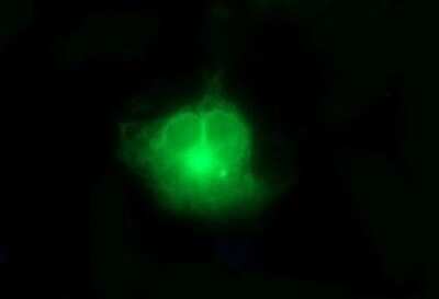 Immunocytochemistry/ Immunofluorescence: FA2H Antibody (OTI2E3) - Azide and BSA Free [NBP2-72192]