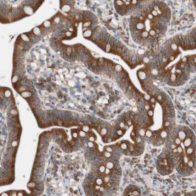 Immunohistochemistry-Paraffin: FAAH Antibody [NBP1-83937]