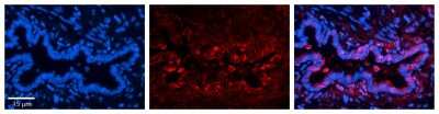 Immunohistochemistry: FAAP Antibody [NBP1-56855]