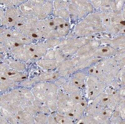 Immunohistochemistry-Paraffin: FAAP Antibody [NBP1-83175]