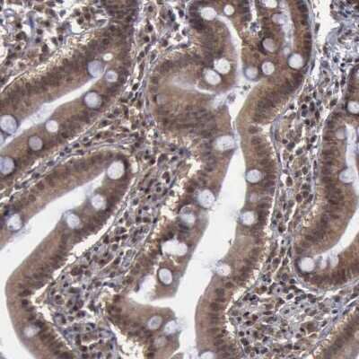 Immunohistochemistry-Paraffin: FAAP Antibody [NBP1-83175]