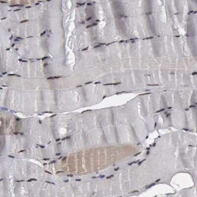 Immunohistochemistry-Paraffin: FAAP Antibody [NBP1-83175]