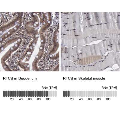 Immunohistochemistry-Paraffin: FAAP Antibody [NBP1-83175]