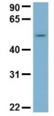 Western Blot: FAAP Antibody [NBP1-56855]