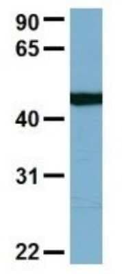 Western Blot: FAAP Antibody [NBP1-56855]