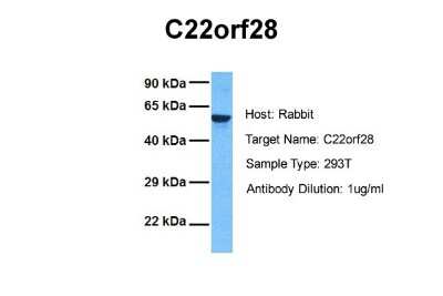 Western Blot: FAAP Antibody [NBP1-56855]
