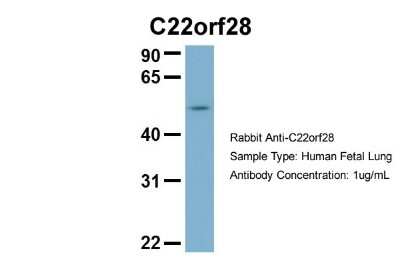 Western Blot: FAAP Antibody [NBP1-56855]