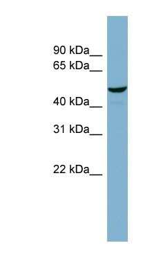 Western Blot: FAAP Antibody [NBP1-56856]