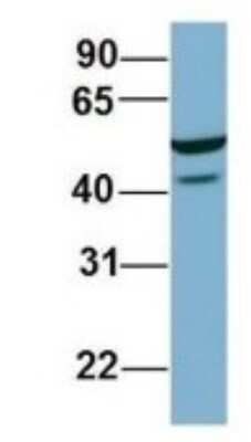 Western Blot: FAAP Antibody [NBP1-56856]