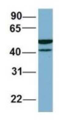 Western Blot: FAAP Antibody [NBP1-56856]