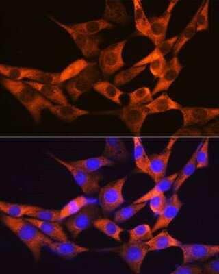 Immunocytochemistry/ Immunofluorescence: FABP1/L-FABP Antibody (8Q8S10) [NBP3-15353]