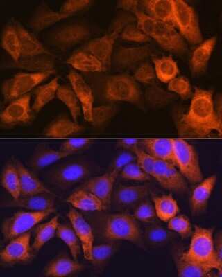 Immunocytochemistry/ Immunofluorescence: FABP1/L-FABP Antibody (8Q8S10) [NBP3-15353]