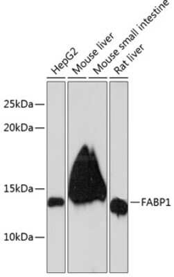 Western Blot: FABP1/L-FABP Antibody (8Q8S10) [NBP3-15353]