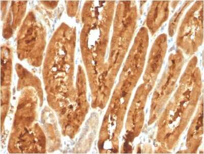 Immunohistochemistry-Paraffin: FABP1/L-FABP Antibody (FABP1/3487) - Azide and BSA Free [NBP3-08949]