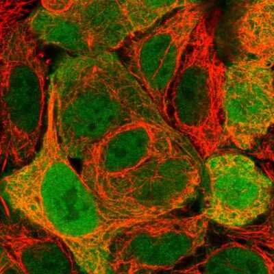 Immunocytochemistry/ Immunofluorescence: FABP1/L-FABP Antibody [NBP1-87695]
