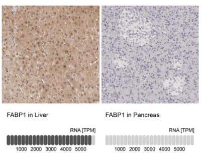 Immunohistochemistry-Paraffin: FABP1/L-FABP Antibody [NBP1-87695]