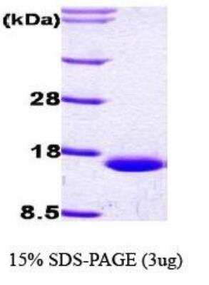 SDS-PAGE: Recombinant Human FABP1/L-FABP His Protein [NBC1-18503]