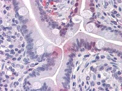 Immunohistochemistry-Paraffin: FABP2/I-FABP Antibody (9A9B7B3) - BSA Free [NBP1-51589]
