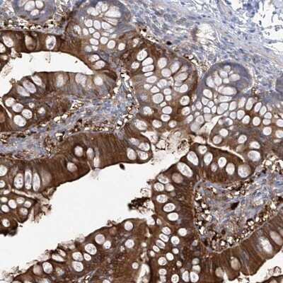 Immunohistochemistry-Paraffin: FABP2/I-FABP Antibody [NBP1-87696]
