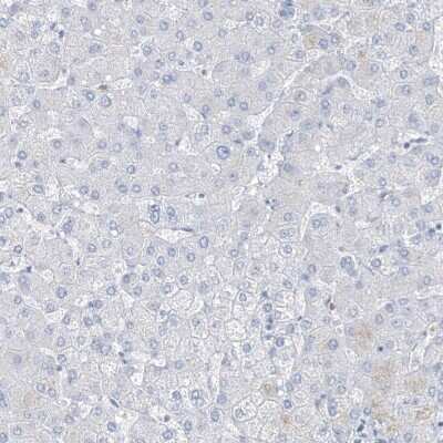 Immunohistochemistry-Paraffin: FABP2/I-FABP Antibody [NBP1-87696]