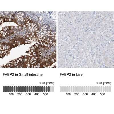 Immunohistochemistry-Paraffin: FABP2/I-FABP Antibody [NBP1-87696]