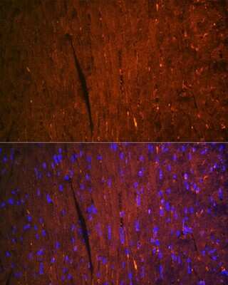 Immunohistochemistry: FABP3/H-FABP Antibody (9B9D7) [NBP3-16508]