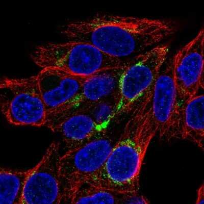 Immunocytochemistry/ Immunofluorescence: FABP3/H-FABP Antibody [NBP2-33763]