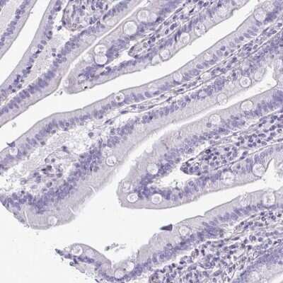 Immunohistochemistry-Paraffin: FABP3/H-FABP Antibody [NBP2-33763]