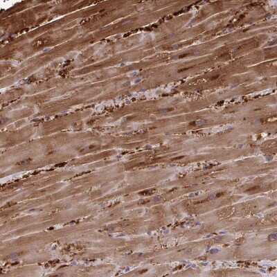 Immunohistochemistry-Paraffin: FABP3/H-FABP Antibody [NBP2-33763]