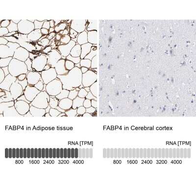 Immunohistochemistry-Paraffin: FABP4/A-FABP Antibody [NBP1-89218]
