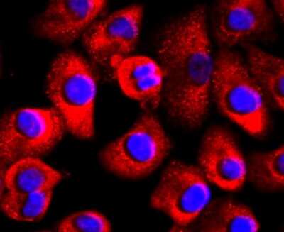 Immunocytochemistry/ Immunofluorescence: FABP4/A-FABP Antibody (JM10-99) [NBP2-66828]