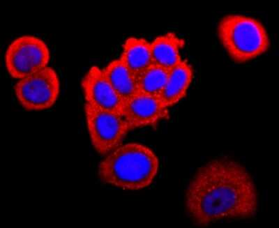 Immunocytochemistry/ Immunofluorescence: FABP4/A-FABP Antibody (JM10-99) [NBP2-66828]