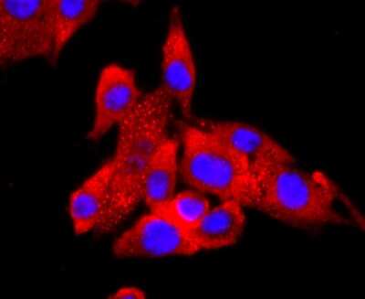 Immunocytochemistry/ Immunofluorescence: FABP4/A-FABP Antibody (JM10-99) [NBP2-66828]