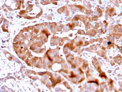 Immunohistochemistry-Paraffin: FABP5/E-FABP Antibody (FABP5/3750) - Azide and BSA Free [NBP2-79929]