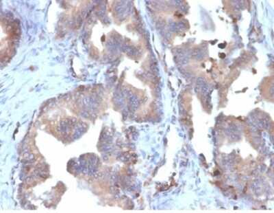 Immunohistochemistry-Paraffin: FABP5/E-FABP Antibody (FABP5/6353R) [NBP3-13882]